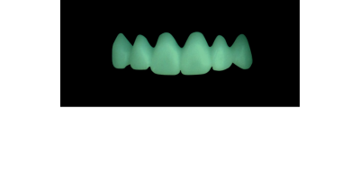 Cod.C8Facing : 10x  wax facings-bridges,  SMALL, Tapering ovoid, TOOTH 13-23, compatible with Cod.A8Lingual,TOOTH 13-23 for long-term provisionals preparation